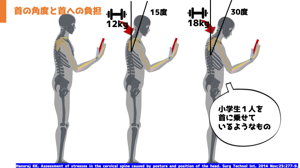 画像に alt 属性が指定されていません。ファイル名: スマホ首.png
