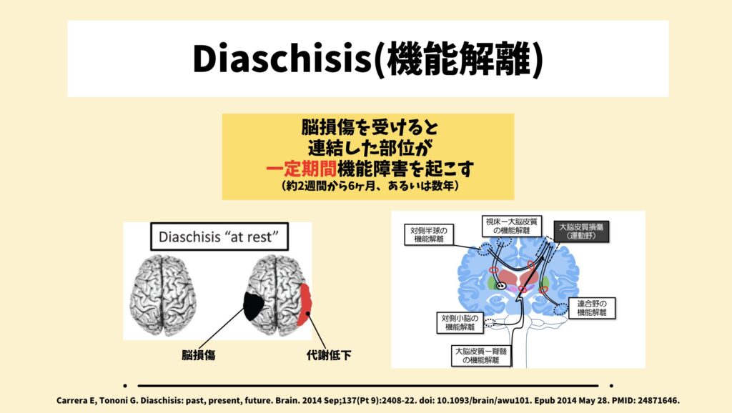 Diaschisis