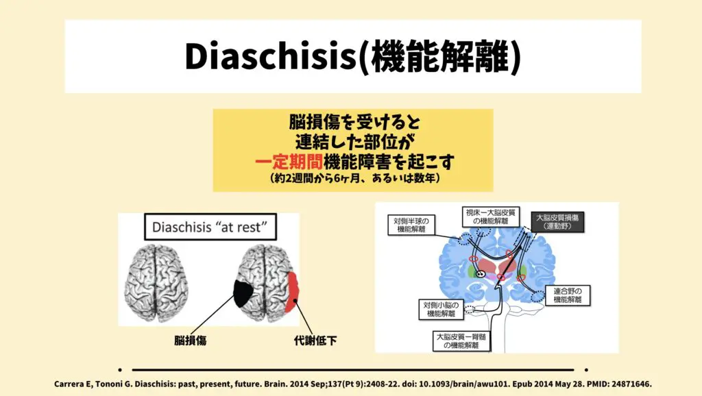 2024年最新版】皮質脊髄路とは？脳卒中認定理学療法士が解説