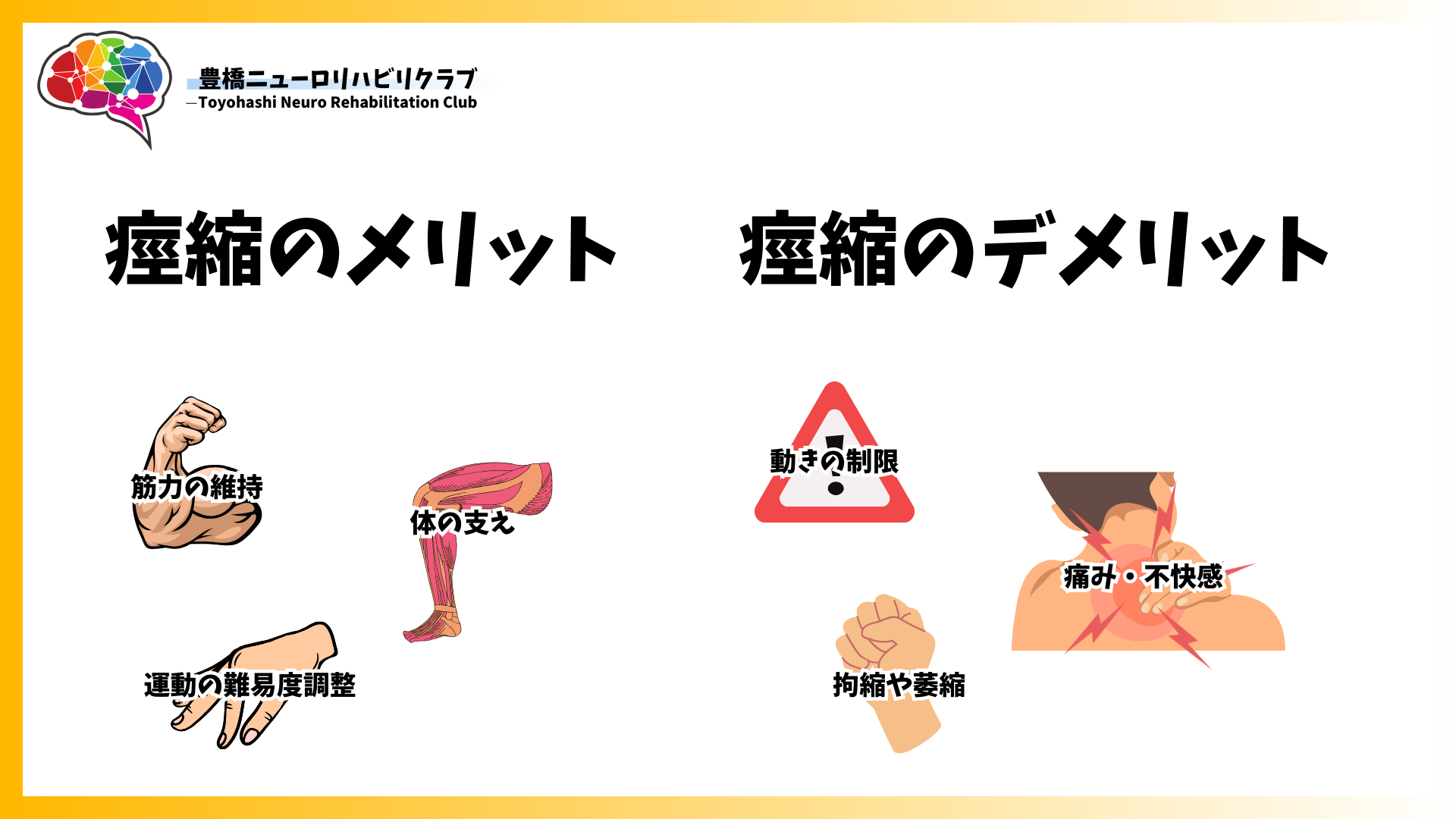 【絶対知っておきたい】痙縮について、どこよりもわかりやすく解説 愛知県豊橋市で脳梗塞・脳出血後遺症に特化したマンツーマンリハビリなら