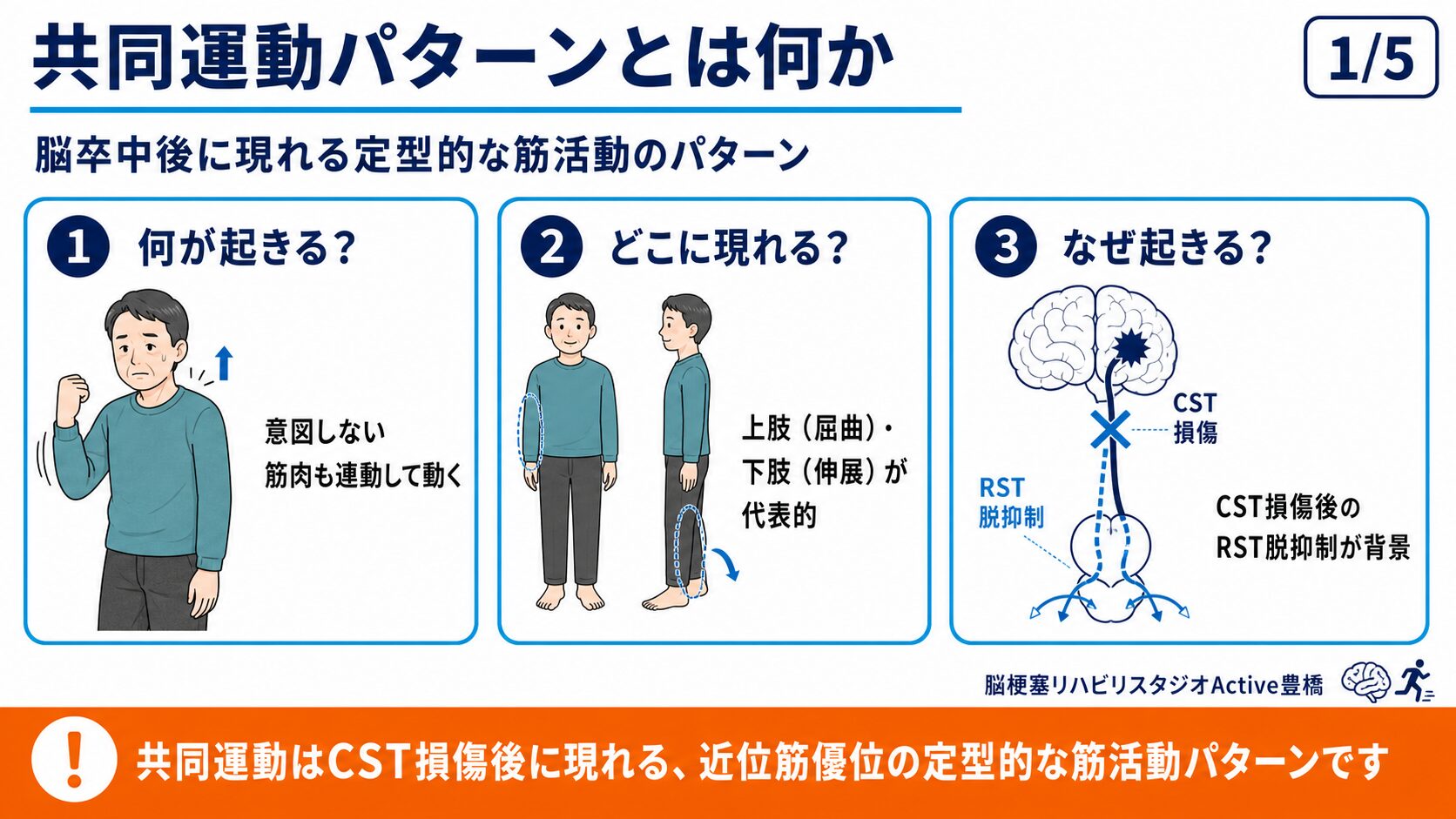共同運動パターンとは何か：CST損傷後に現れる定型的な筋活動パターン