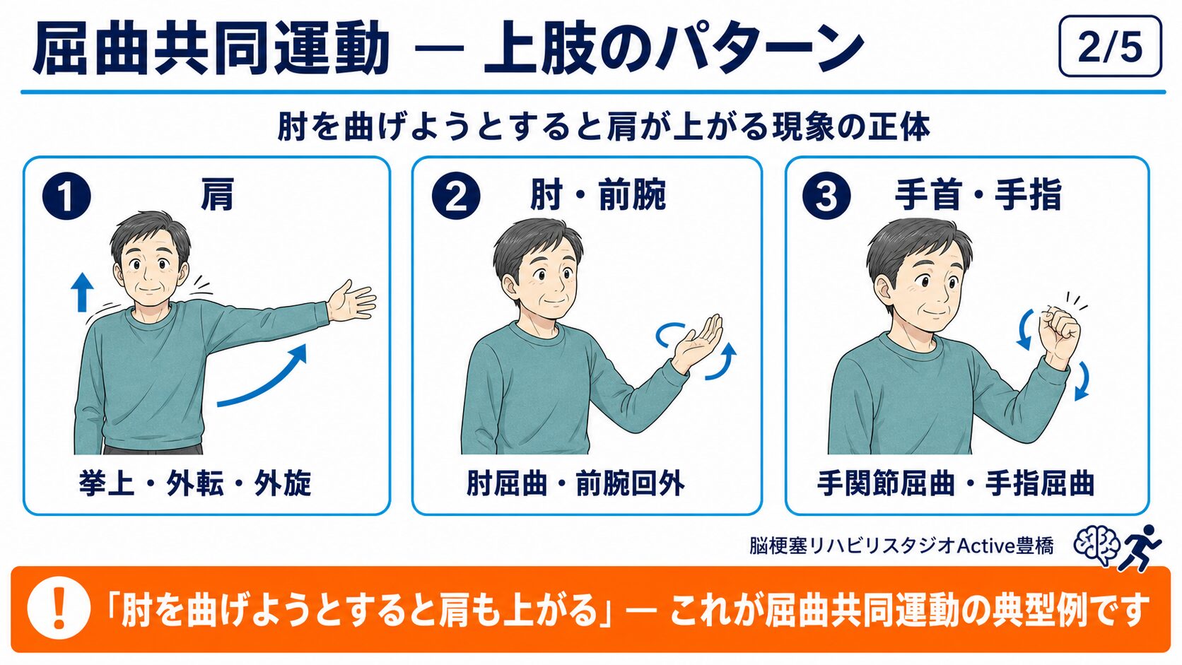 屈曲共同運動のパターン：肩・肘・前腕・手指の連動