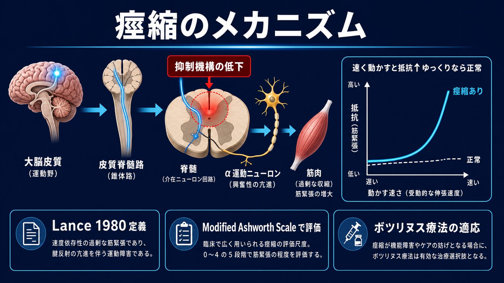 痙縮のメカニズム：抑制機構の低下と速度依存性の筋緊張亢進