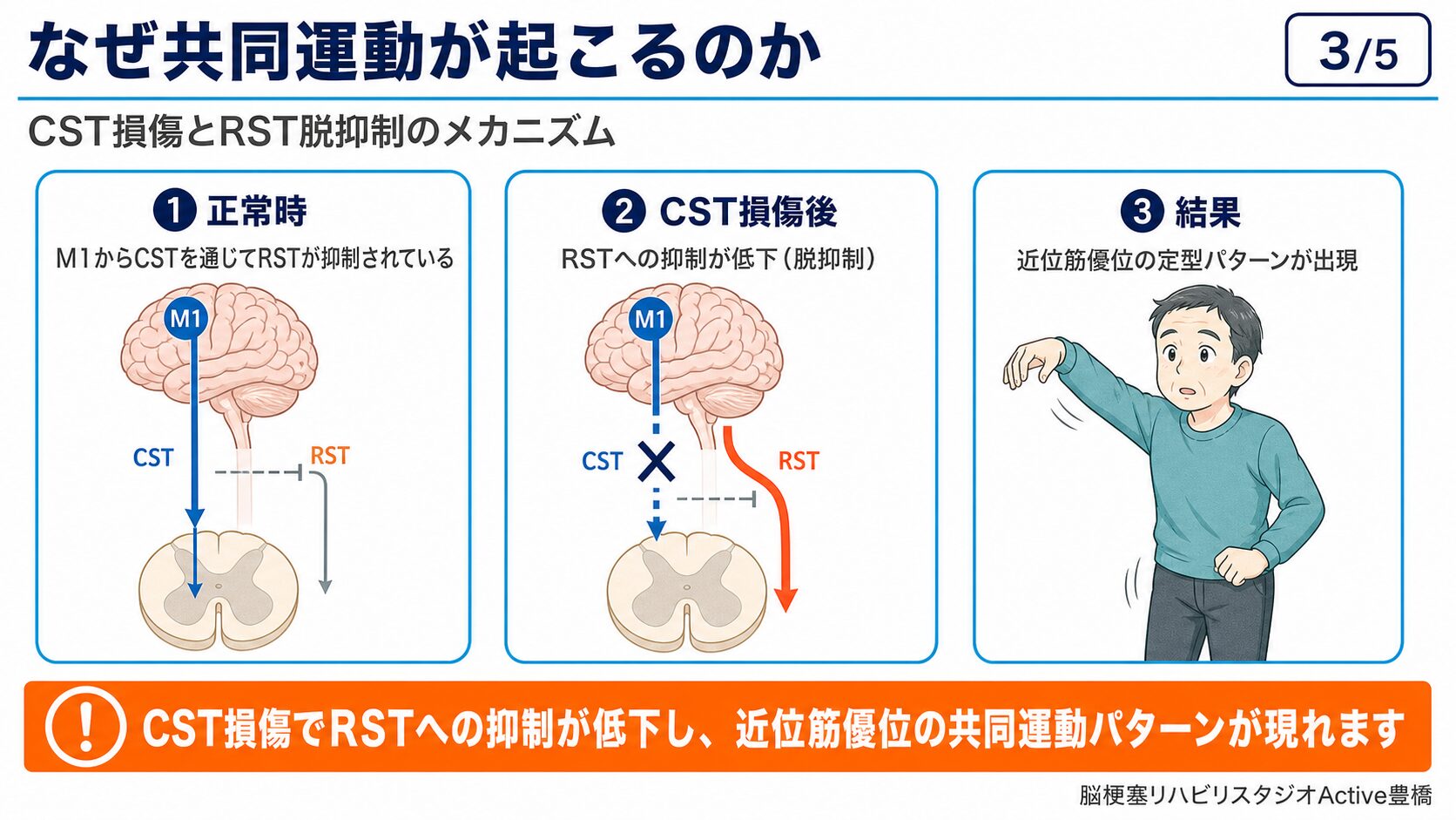 共同運動への向き合い方：代償として活用するか選択的運動を目指すか