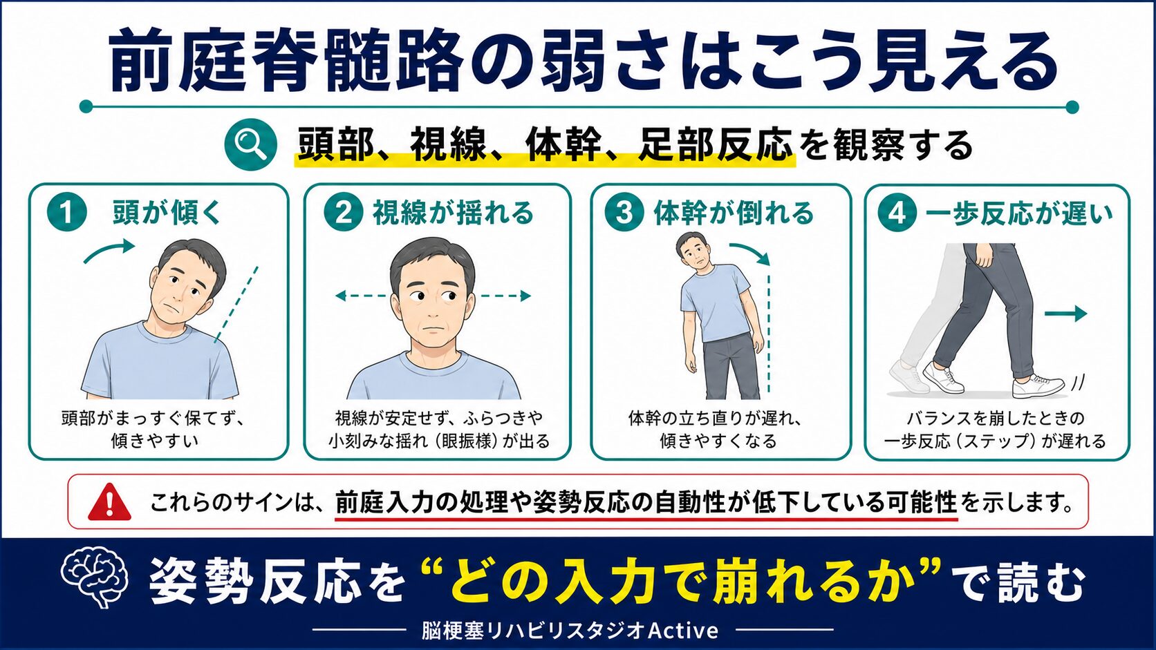 前庭脊髄路を脳卒中リハビリで解説する図解スライド2
