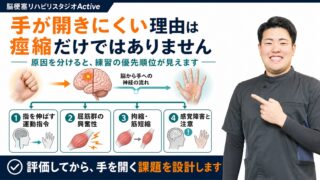 脳梗塞後に手が開きにくい理由|痙縮だけでなく評価すべき4つの原因