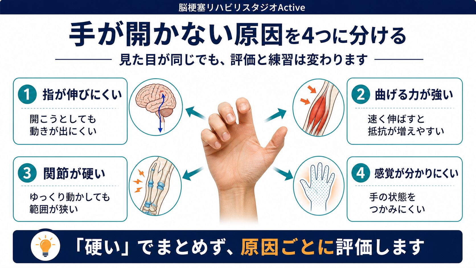 脳卒中後に手が開きにくい状態の図解