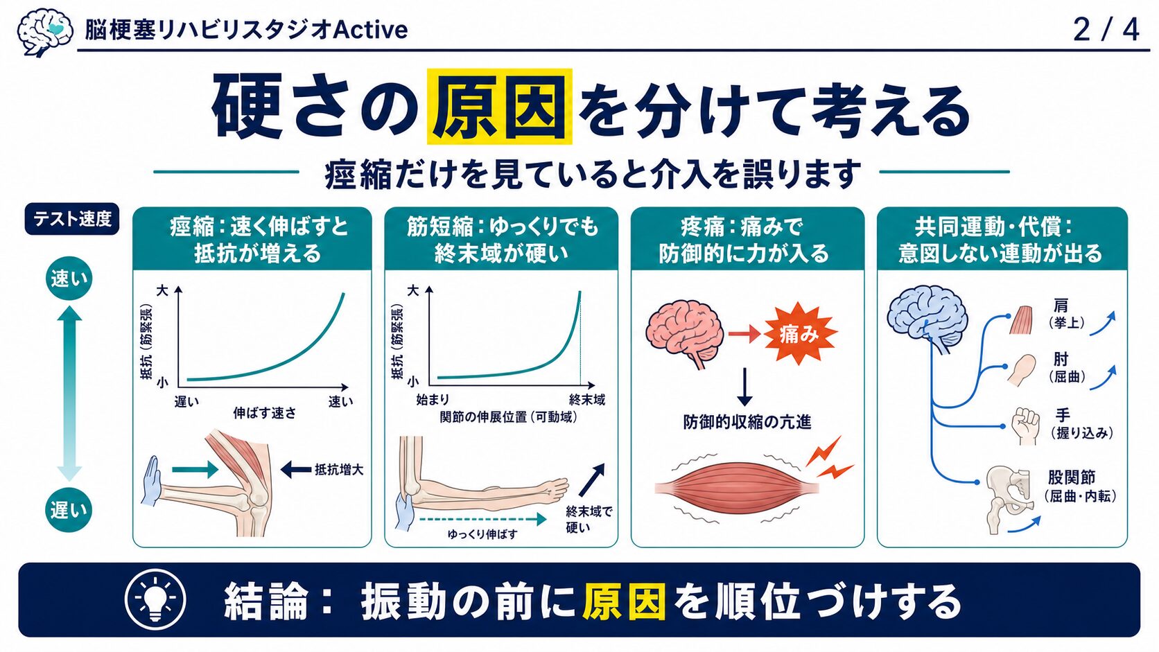 痙縮と筋短縮と疼痛を評価で区別する図解