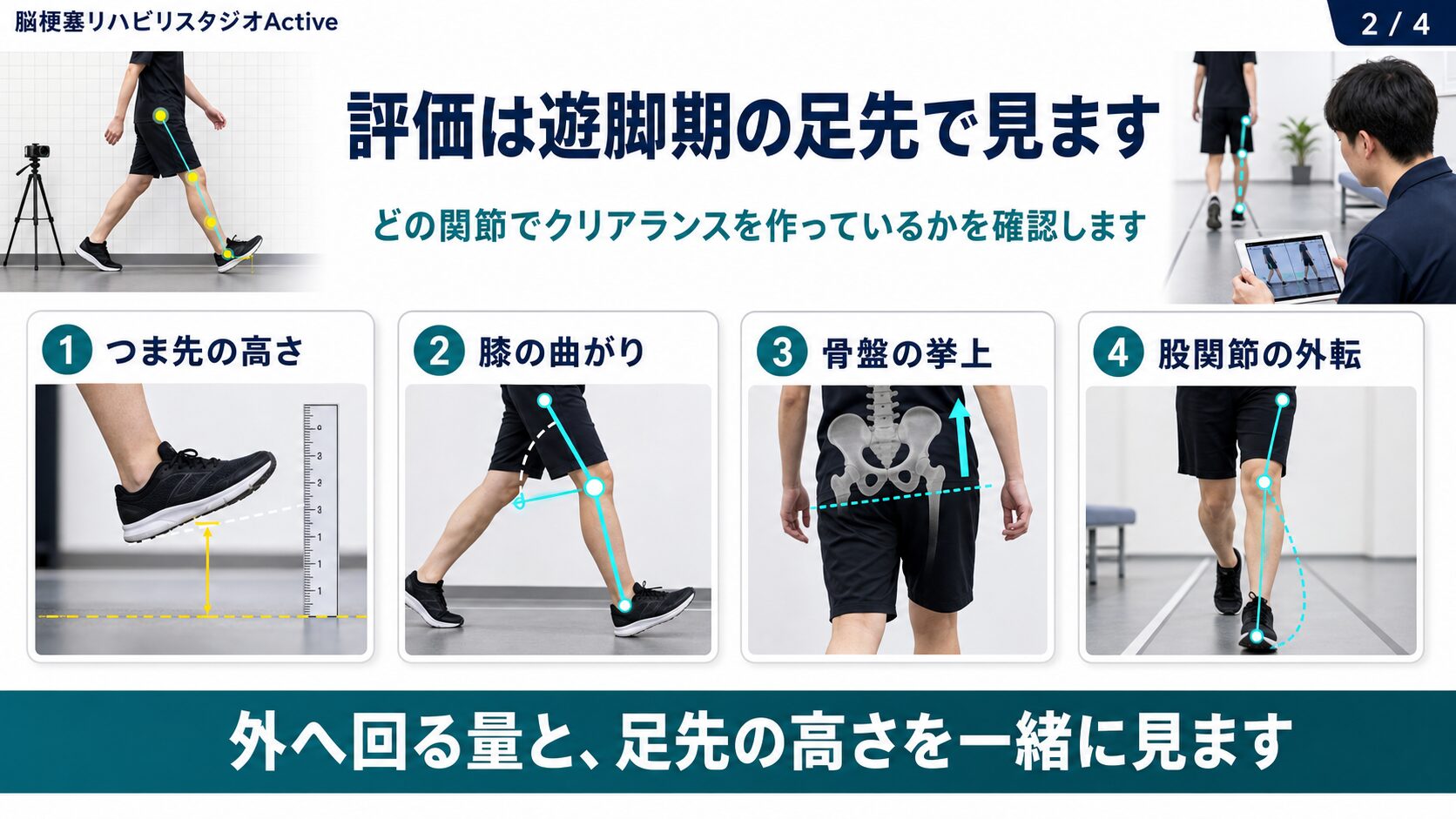 ぶん回し歩行の評価でつま先、膝、骨盤、股関節を見るスライド