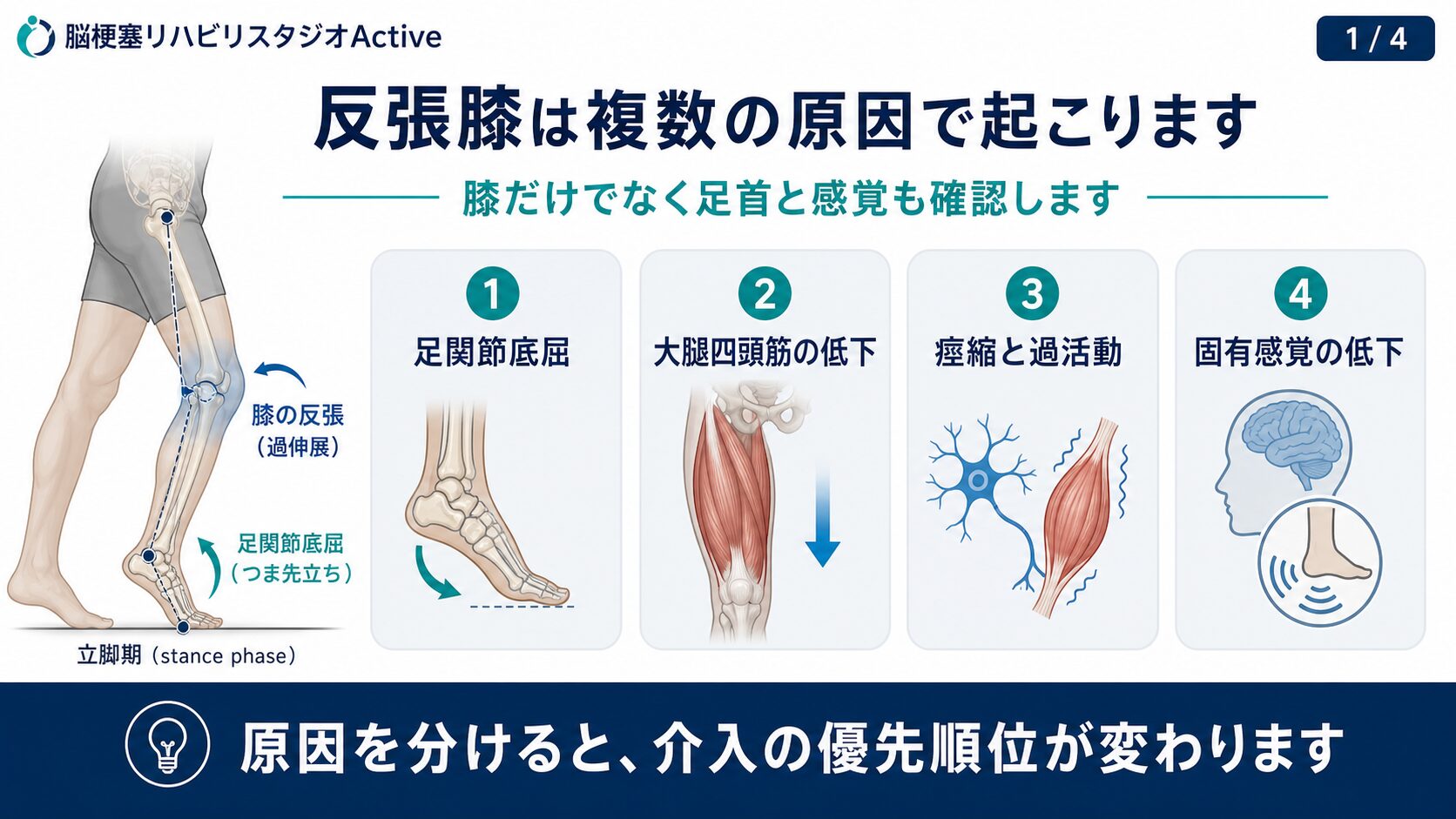 脳卒中後の反張膝の図解