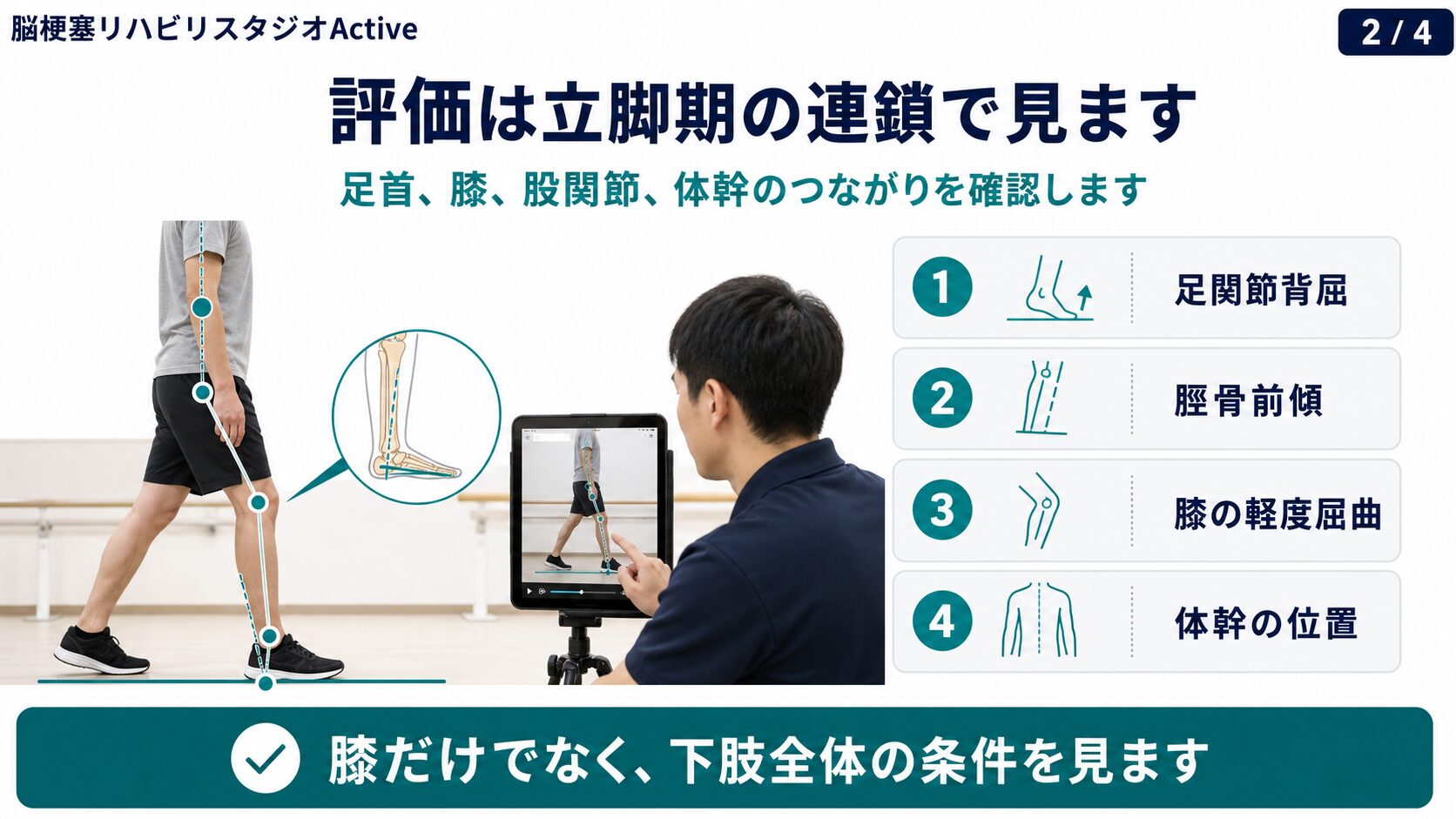 脳卒中後の反張膝の評価図解