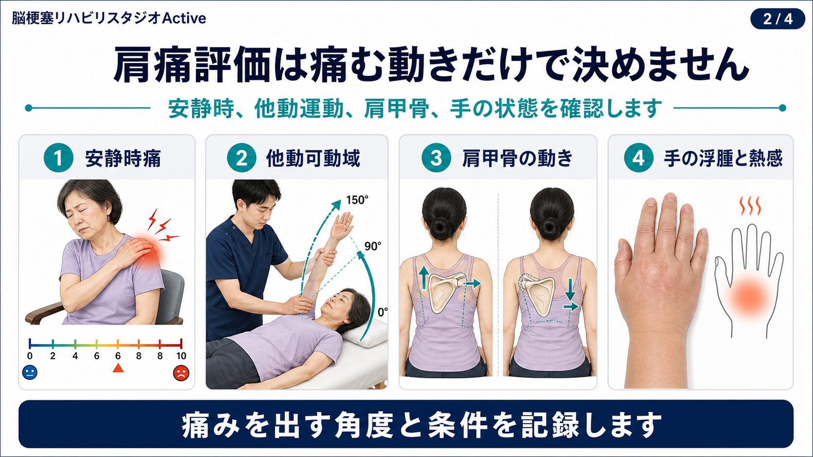 脳卒中後の肩痛の評価図解