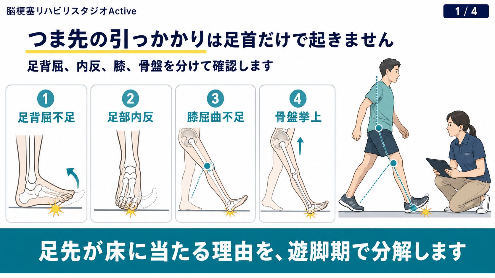 脳卒中後につま先が引っかかる状態の図解