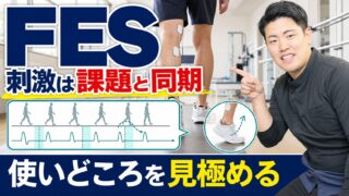 FESはいつ使うべきか|脳卒中リハビリで刺激を課題に同期させる考え方
