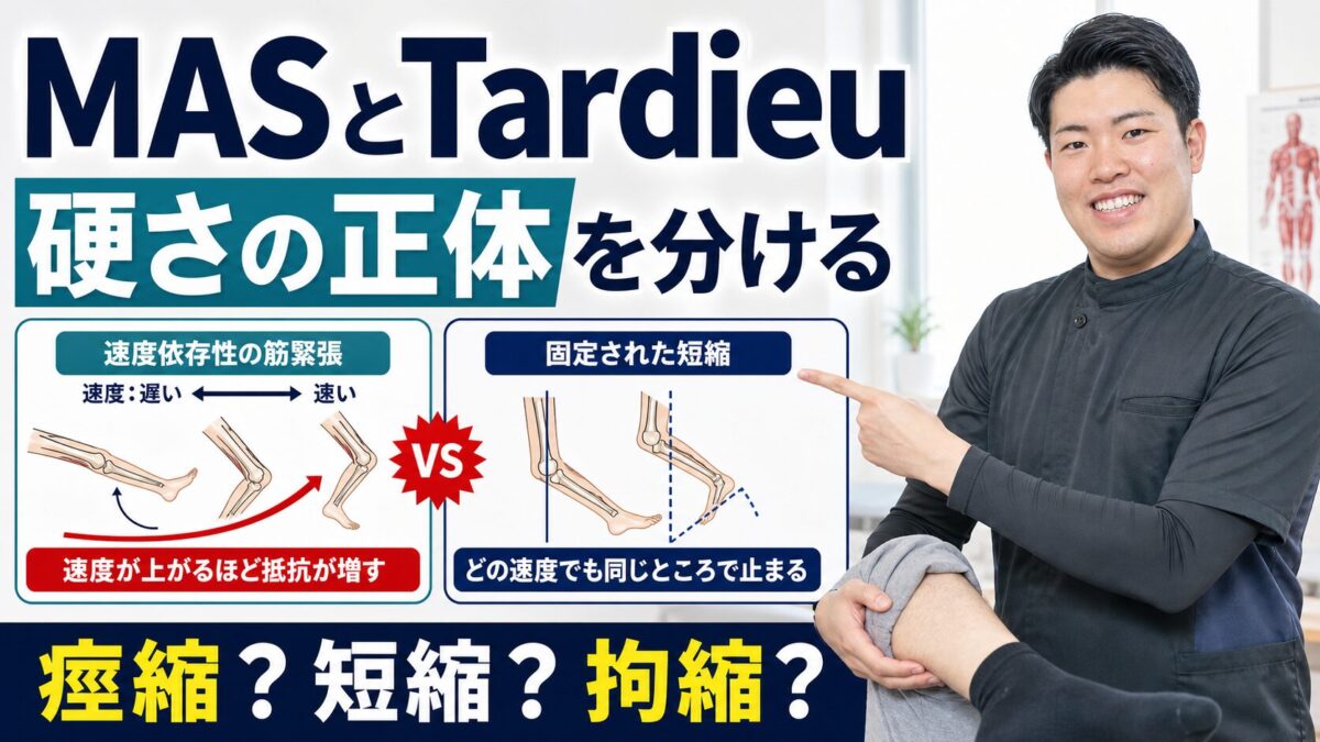 MASとTardieuで痙縮、短縮、拘縮を分ける考え方のサムネイル