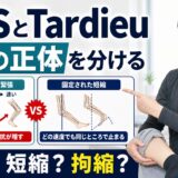 MASとTardieuで痙縮、短縮、拘縮を分ける考え方のサムネイル