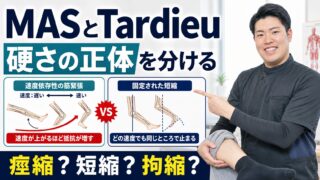 MASとTardieuは硬さの見方が違う｜脳卒中後の痙縮を評価で分ける