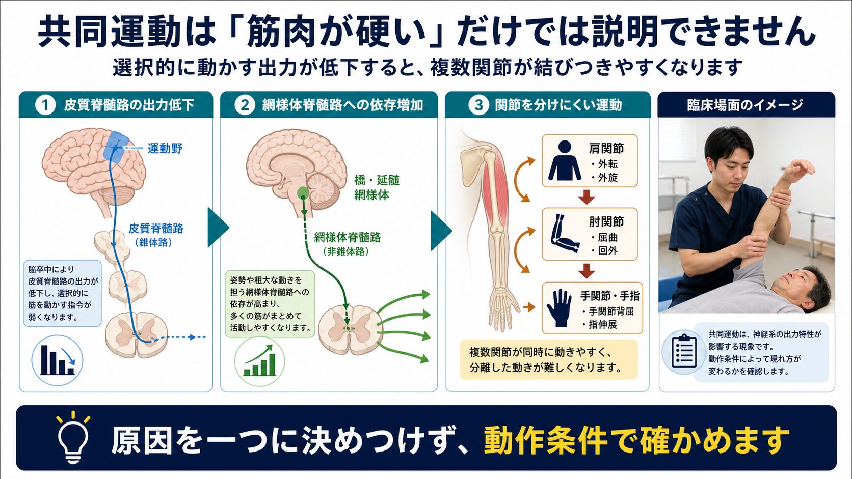 脳卒中後の共同運動と皮質脊髄路および網様体脊髄路の関係を示す図解