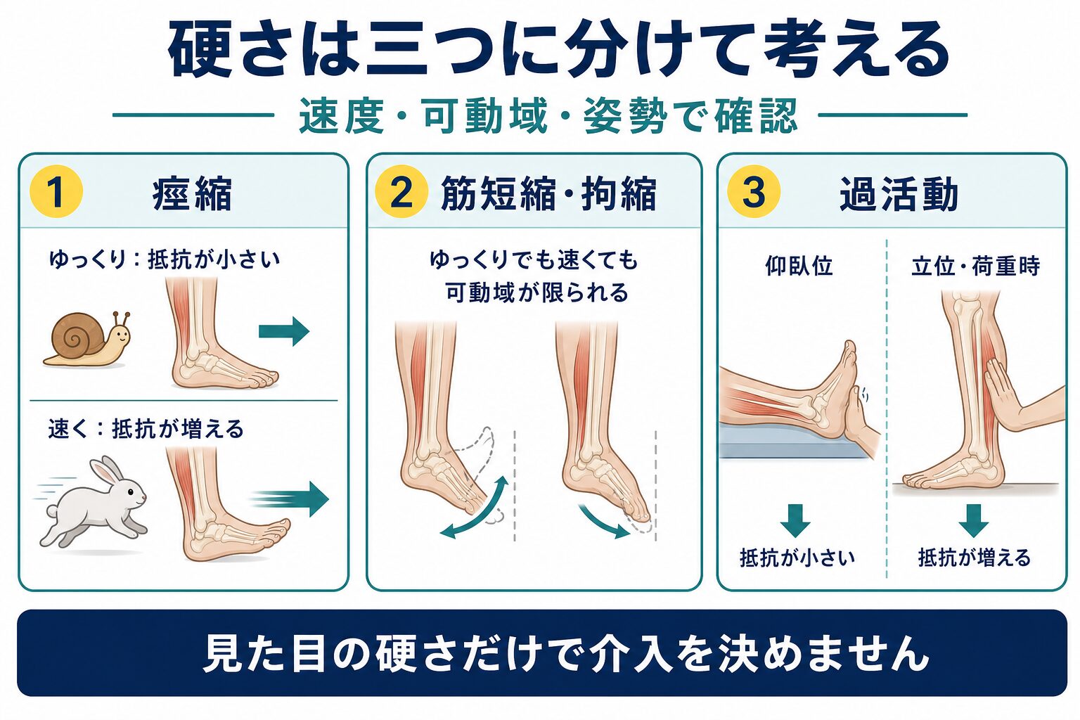 痙縮を一つの原因にせず速度、可動域、姿勢で評価する図