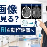脳卒中後のCTとMRIを動作評価へつなげる脳画像リハビリのサムネイル