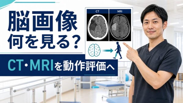 脳卒中後の脳画像は何を見るか｜CT・MRIを動作の評価とリハビリ設計につなげる