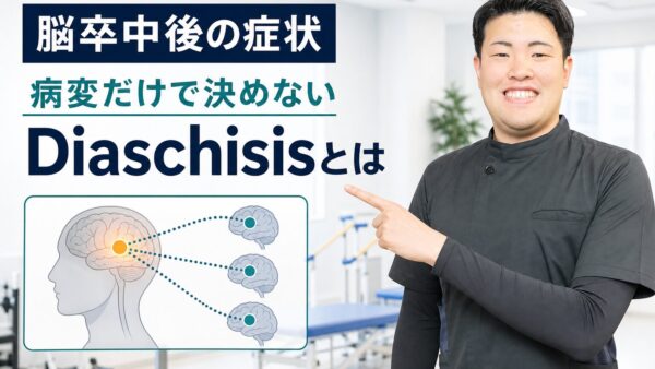Diaschisisとは｜脳卒中後の症状を病変だけで決めず、ネットワークから評価する