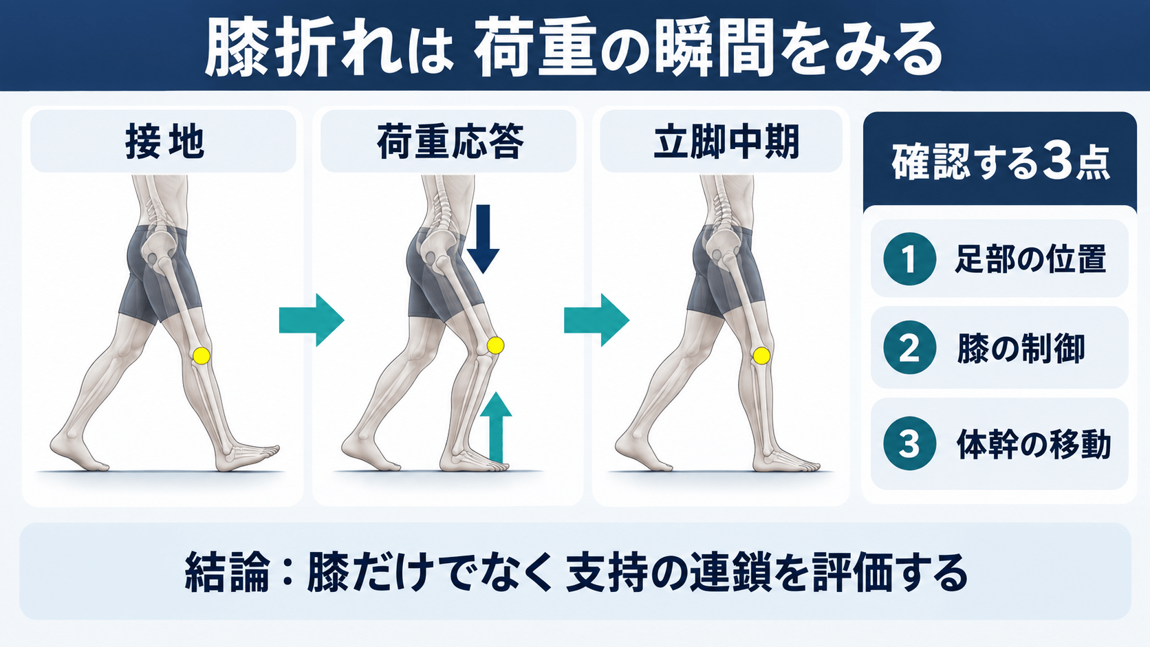 脳卒中後の膝折れを接地、荷重、体幹、足関節に分けて考える図解