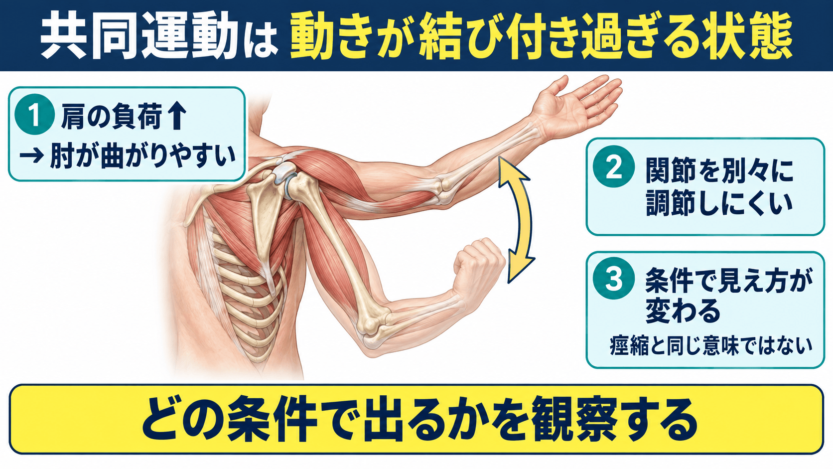 脳卒中後の共同運動を、肩の外転と肘の屈曲が結び付く例で示した図解