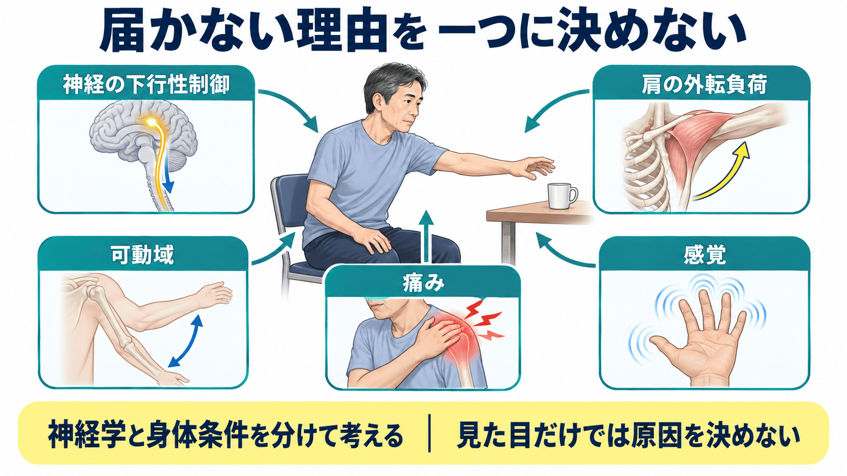 共同運動の要因を、神経の下行性制御、肩の負荷、可動域、痛み、感覚に分けた図解