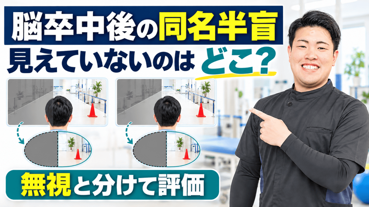 脳卒中後の同名半盲を無視と分けて評価する理学療法士のアイキャッチ