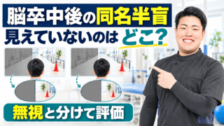 脳卒中後の同名半盲とは｜半側空間無視と分けて安全な探索を設計する