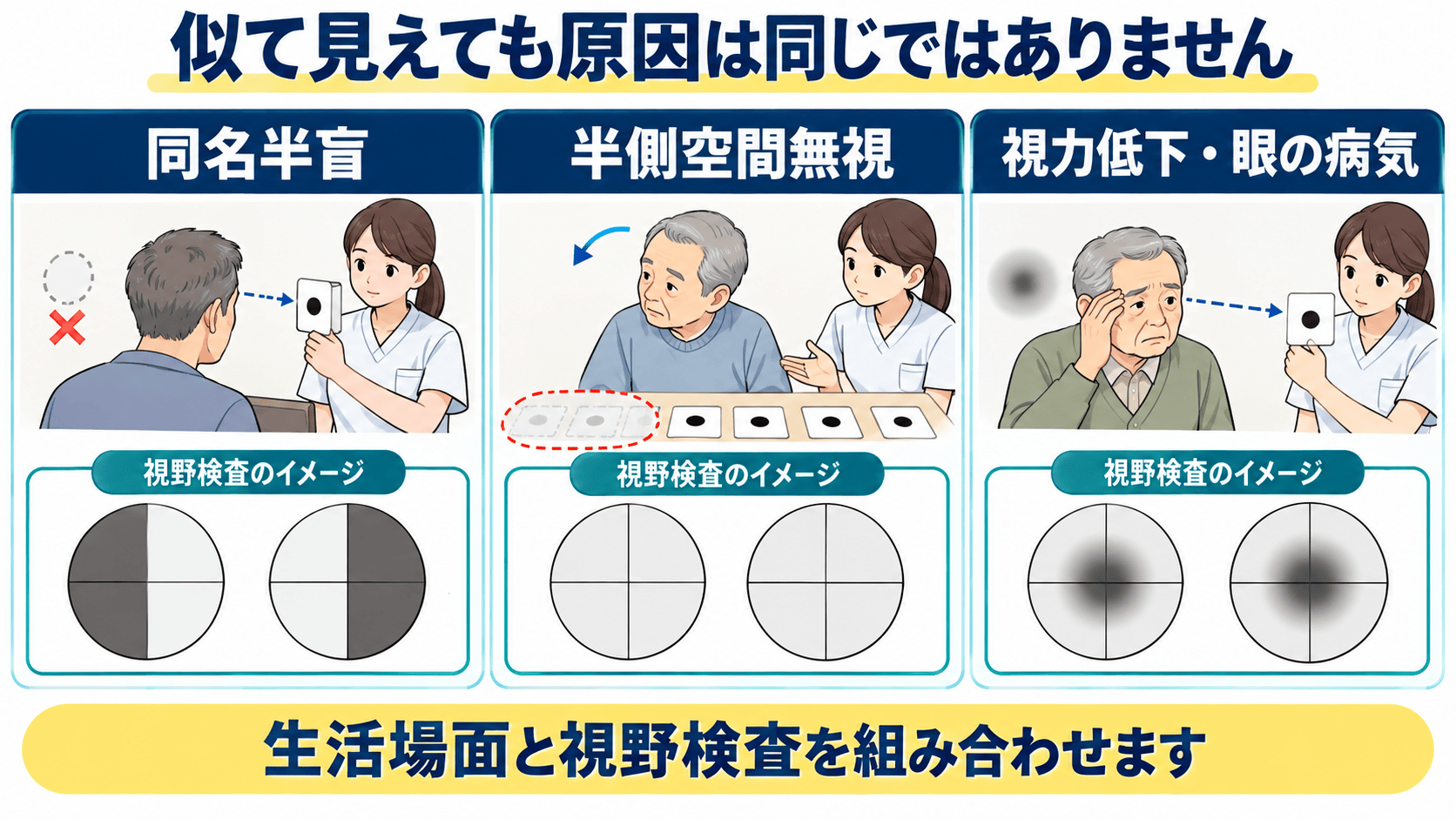 同名半盲と半側空間無視、視力低下や眼の病気を分けて考える図
