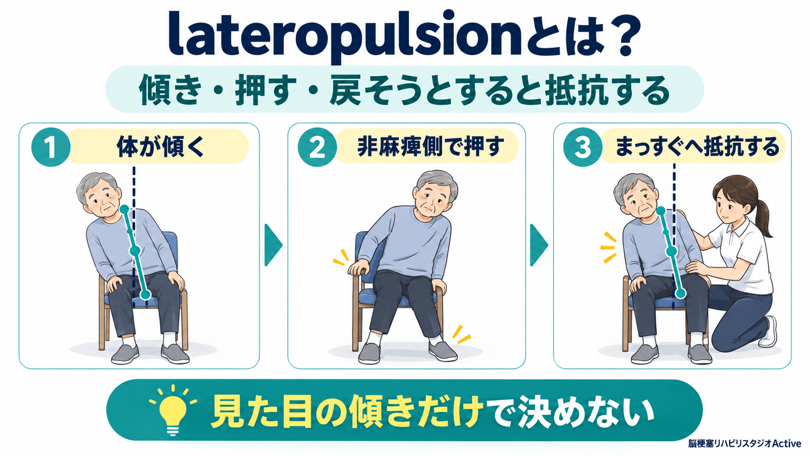 lateropulsionの傾き、押す反応、修正への抵抗を示す図