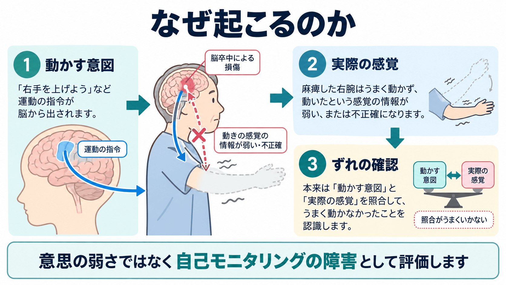 脳卒中後に麻痺の自覚が難しくなる自己モニタリングの図解